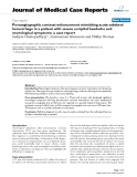 Báo cáo y học: "  Postangiographic contrast enhancement mimicking acute subdural hemorrhage in a patient with severe occipital headache and neurological symptoms: a case report"