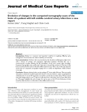Báo cáo y học: " Evolution of changes in the computed tomography scans of the brain of a patient with left middle cerebral artery infarction: a case report"