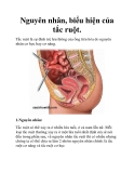 Nguyên nhân, biểu hiện của tắc ruột.