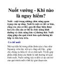 Nuốt vướng - Khi nào là nguy hiểm?