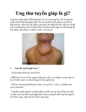 Ung thư tuyến giáp là gì?