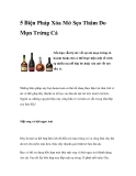 5 Biện Pháp Xóa Mờ Sẹo Thâm Do Mụn Trứng Cá