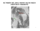 SỰ PHIÊN MÃ rRNA TRONG HẠCH NHÂN (TRITURUS VIRIDENS)