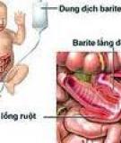 Lồng ruột – chứng bệnh cực nguy hiểm với bé