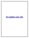 Phương pháp xét nghiệm nước tiểu
