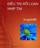 Tổng quan về rối loạn nhịp tim 