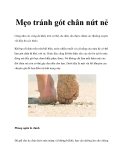 Mẹo tránh gót chân nứt nẻ