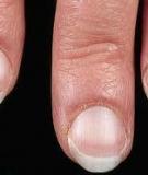 Móng cần sự chăm sóc sau khi làm nail 