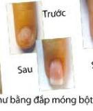 Kỹ thuật tạo móng gel trắng