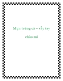 Mụn trứng cá – vẫy tay chào mi