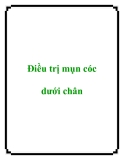 Điều trị mụn cóc dưới chân