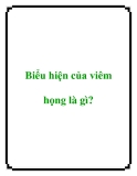 Biểu hiện của viêm họng là gì?