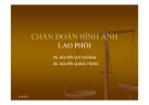 Bài giảng Chẩn đoán hình ảnh lao phổi - BS. Nguyễn Quý Khoáng, BS. Nguyễn Quang Trọng