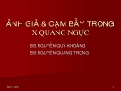 X quang ngực