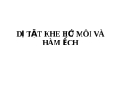 DỊ TẬT KHE HỞ MÔI VÀ HÀM ẾCH
