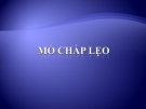 MỔ CHẮP LẸO