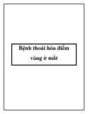 Bệnh thoái hóa điểm vàng ở mắt