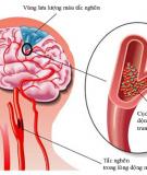 Thuốc tuần hoàn não và lưu ý khi sử dụng