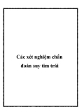 Các xét nghiệm chẩn đoán suy tim trái