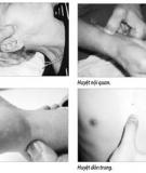 Xoa bóp bấm huyệt phòng trị nhịp tim nhanh