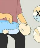 Xử trí khi bé hóc thạch