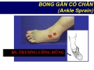 Bài giảng Bong gân cổ chân - BS. Trương Công Dũng