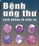 Cách phòng và điều trị bệnh ung thư: Phần 2