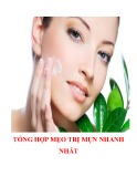 Tổng hợp mẹo trị mụn nhanh nhất