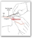 Thực trạng chăm sóc dinh dưỡng của điều dưỡng viên các khoa Lâm sàng và một số yếu tố liên quan tại Bệnh viện nhi Trung ương năm 2013 - ĐH Y tế Công cộng
