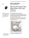 Hóa trị để ngăn chận mạch máu nuôi gan: Điều trị ung thư