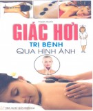 Hướng dẫn Giác hơi trị bệnh qua hình ảnh: Phần 1