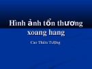 Bài giảng Hình ảnh tổn thương xoang hang - Cao Thiên Tượng