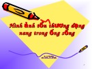 Bài giảng Hình ảnh tổn thương dạng nang trong ống sống - BS. Lê Văn Dũng