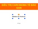 Bài giảng Điều trị Carcinoma tế bào gan