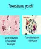 Bệnh Toxoplasma