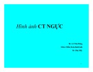 Bài giảng Hình ảnh CT ngực - BS.Lê Văn Dũng