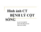 Bài giảng Hình ảnh CT bệnh lý cột sống - BS. Lê Văn Phước (54tr)