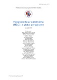 Hepatocellular carcinoma (HCC): A global perspective