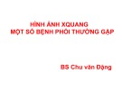 Bài giảng Hình ảnh X quang một số bệnh phổi thường gặp - BS. Chu Văn Đặng