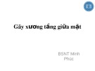 Bài giảng Gãy xương tầng giữa mặt​ - BS. Minh Phúc