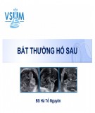 Bài giảng Bất thường hố sau - BS. Hà Tố Nguyên