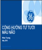 Đề tài Cộng hưởng từ tưới máu não