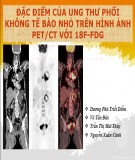 Đề tài nghiên cứu: Đặc điểm của ung thư phổi không tế bào nhỏ trên hình ảnh PETCT với 18F-FDG