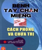 Cách phòng và chữa trị bệnh tay chân miệng: Phần 1