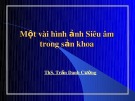 Bài giảng Một vài hình ảnh Siêu âm trong sản khoa - ThS. Trần Danh Cường