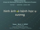 Bài giảng Hình ảnh và bệnh học u xương