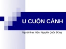 Bài thuyết trình U cuộn cảnh - Nguyễn Quốc Dũng