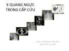 Bài giảng X quang ngực trong cấp cứu - Bệnh viện Chợ Rẫy