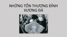 Bài giảng Những tổn thương đỉnh xương đá