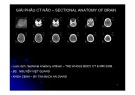 Bài giảng Giải phẫu CT não – Sectional anatomy of brain